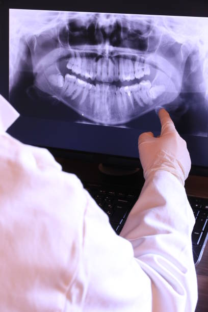 Best Knocked-Out Tooth (Avulsed Tooth) Treatment in Pawcatuck, CT